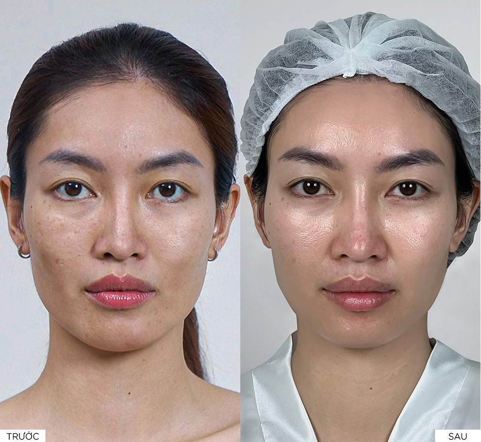 Kết quả điều trị