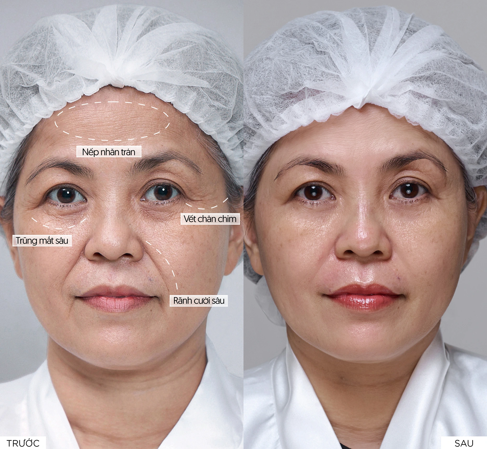 Ảnh hiển thị