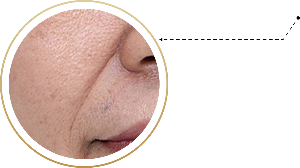 Zoom 3