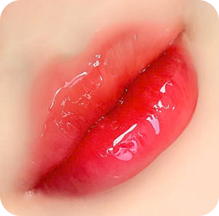 Cấy môi Diamond Lips