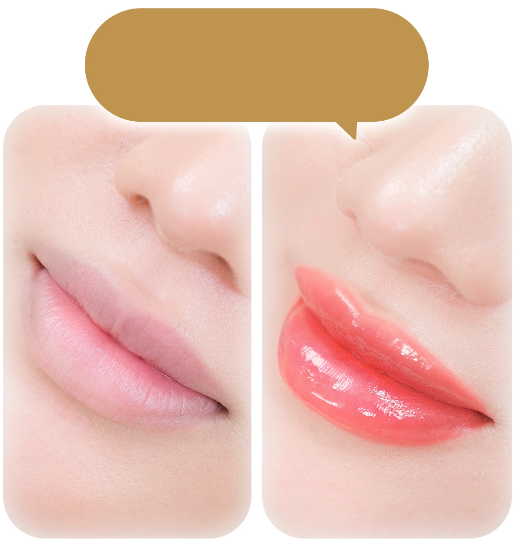 Phun môi collagen cải thiện môi thâm xỉn màu và môi nhợt nhạt