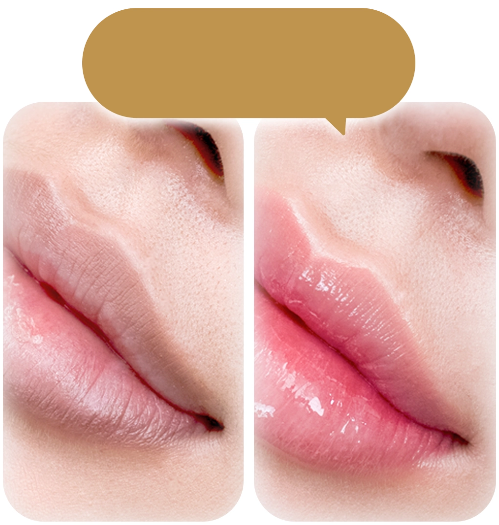 Phun môi collagen cải thiện môi khô nứt nẻ
