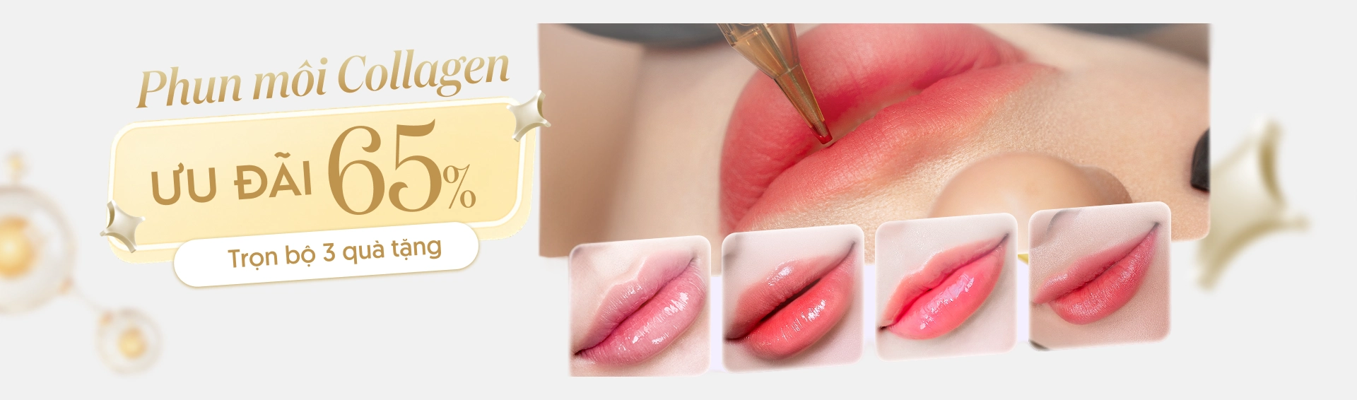Khuyến mãi phun môi collagen chỉ từ 2 triệu đồng tại Linh Anh