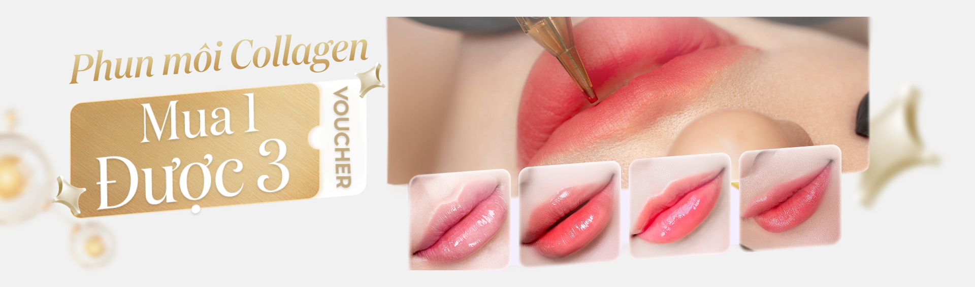 Khuyến mãi phun môi collagen chỉ từ 2 triệu đồng tại Linh Anh